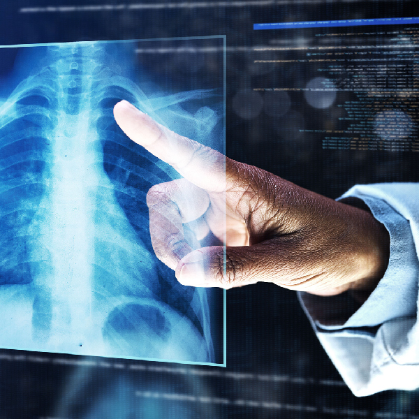 Radiology Workflow Optimization - Canopy Partners